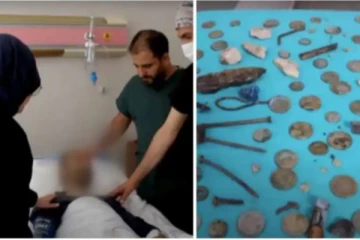 வயிற்றில் இருந்து எடுக்கப்பட்ட ஆணி, கல், நாணயங்கள்.. அதிர்ச்சியில் மருத்துவர்கள்!