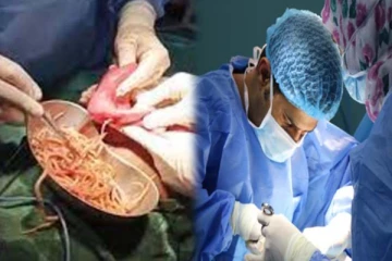 வயிறுவலியால் துடித்த சிறுவன்! ஒரு கிலோ புழுவை எடுத்து அதிர்ச்சி கொடுத்த மருத்துவர்கள்