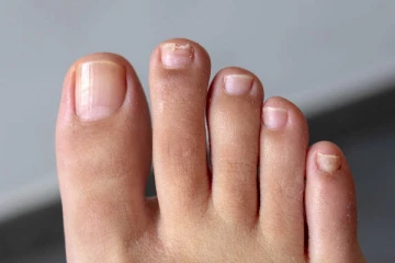 நகங்களில் சொத்தையா? இதை மட்டும் தினமும் தடவுங்க....சொத்தை வந்த இடம் தெரியாமல் ஓடிடும்!