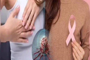 இலங்கையில் மார்பக புற்றுநோயால் இறப்பவர்களின் எண்ணிக்கை அதிகரிப்பு