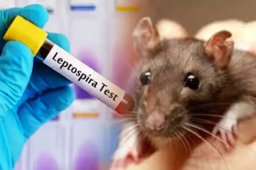 வவுனியாவில் வேகமாக பரவும் எலிக்காய்ச்சல்