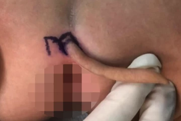 நீளமான வாலுடன் பிறந்த அதிசய பெண் குழந்தை! வியக்க வைத்த மருத்துவர்கள் - தீயாய் பரவும் புகைப்படம்