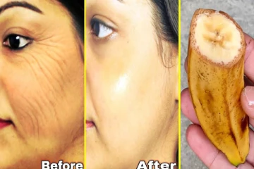 Banana For Skin: முகத்தை ஜொலிக்க வைக்கும் வாழைப்பழம்