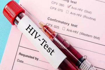 ගාල්ල දිස්ත්‍රික්කයේ HIV ආසාදිතයින්ගේ සංඛ්‍යාව ඉහළට. සෞඛ්‍ය අංශයෙන් අනතරු ඇඟවීමක්.