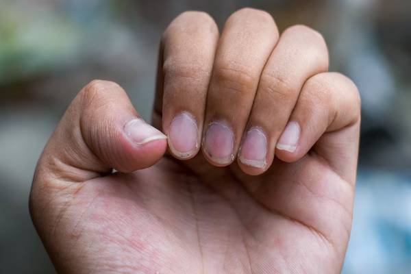 நீங்கள் எவ்வளவு காலம் வாழ்வீர்கள் என்று உங்கள் நகமே சொல்லும்... எப்படி தெரியுமா? | Your Nails Will Tell You How Long You Will Live