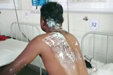 கொடுத்த கடனை திரும்ப கேட்க போன ஊழியர்கள் - கொதிக்கும் எண்ணெயை ஊற்றிய கொடூரம்!