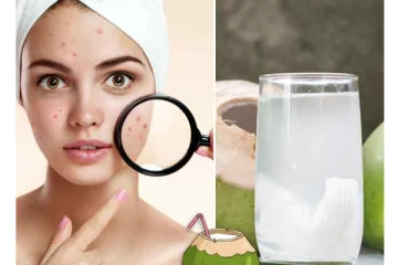 முகத்தில் உள்ள பருக்கள் மாயமாய் மறைய இந்த ஒரு பொருள் போதும்! உடனே ட்ரை பண்ணி பாருங்க