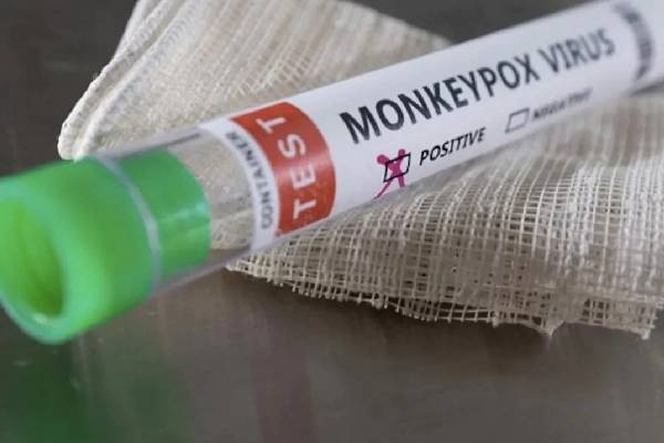 குரங்கு அம்மை பாதித்த இளைஞர் திடீர் மரணம் : கேரளாவில் பரபரப்பு | Monkey Measles Affected Youth Dies