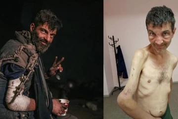 ரஷ்ய இராணுவத்திடம் சிக்கி சித்திரவதைக்குள்ளான உக்ரைனிய வீரர்: முதல் முறையாக மௌன கலைப்பு...