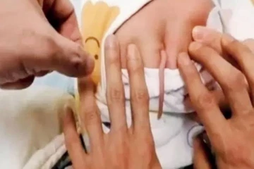 வாலுடன் பிறந்த ஆண் குழந்தை... அச்சரியத்தை ஏற்படுத்திய சம்பவம்!