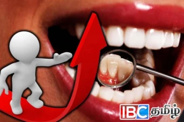 நாட்டிலுள்ள வாய் புற்றுநோயாளர்கள் தொடர்பில் வெளியான அதிர்ச்சி தகவல்