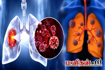 இளம் வயதினரை குறி வைக்கும் நுரையீரல் புற்றுநோய்- இனி செய்யாதீங்க!