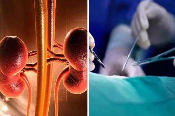 பெண்களை குறிவைத்து கிட்னி திருட்டு - 1 கிட்னிக்கு இவ்வளவா? விசாரணையில் ஷாக்!