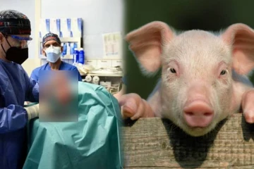 உலகின் 2வது பன்றி இதய மாற்று அறுவை சிகிச்சை.. உயிர்போகும் தருணத்தில் இருந்த நபரை காப்பாற்றிய டாக்டர்கள்!