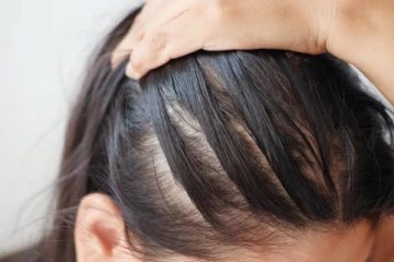 இந்த தவறுகள் தான் தலைமுடி உதிர்வுக்கு காரணமே.. அவசியம் தெரிஞ்சுக்கோங்க!