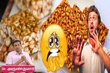 கடலை மிட்டாய் தினமும் சாப்பிடுவது ஆரோக்கியமா? விளக்கும் மருத்துவர் அருண்குமார்