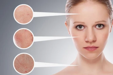 முகத்தில் உள்ள அழுக்கை முற்றிலும் போக்க வேண்டுமா? இதோ சூப்பர் டிப்ஸ்!