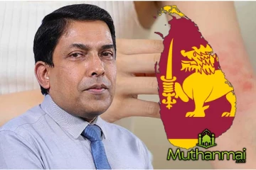 நாட்டில் வேகமாக பரவும் நோய்..! விடுக்கப்பட்ட கடும் எச்சரிக்கை