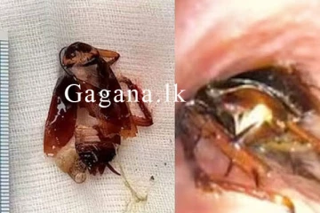 මනුස්සයෙකුගේ පෙනහැල්ලකට කැරපොත්තෙක් ගිය හැටි. - (PHOTOS)