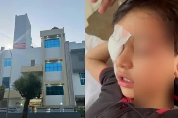 இடது கண்ணுக்கு பதிலாக வலது கண்ணில் ஆப்ரேஷன் - மருத்துவர் செய்த கொடூரம்!