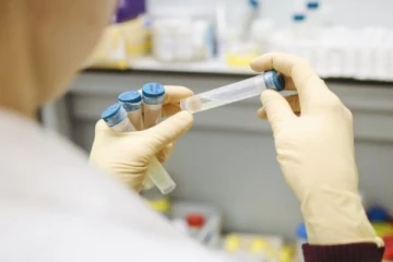 මෙරට තවත් රෝග දෙකක් හිස ඔසවයි..