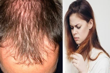 இழந்த முடிகளை திரும்ப பெற இதை சாப்பிடலாம்: ஆய்வில் வெளியான புது தகவல்!