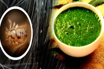 பேன், ஈறு தொல்லைக்கு இன்றோடு முடிவு கட்டும் கை மருந்து- எப்படி செய்யணும் தெரியுமா?