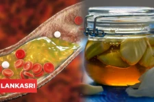 கொலஸ்ட்ராலை உடனே கரைக்கனுமா? இதோ அற்புத தீர்வு