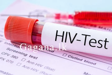 HIV ආසාදිතයින් ගණන ඉහළ යයි.