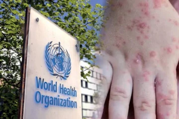 குரங்கு காய்ச்சலை கட்டுப்படுத்துவது தொடர்பில் WHO வெளியிட்ட அதிர்ச்சி தகவல்!