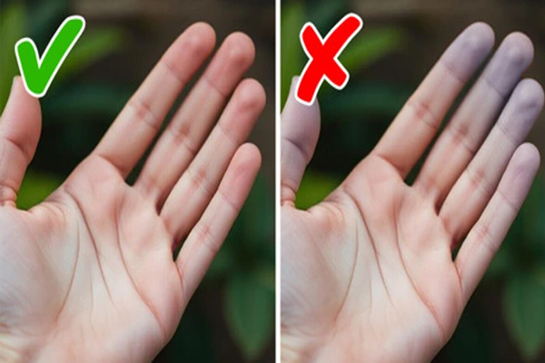 கைகளை வைத்தே உங்க ஆரோக்கியத்தை தெரிஞ்சிக்கலாம்... எப்படினு தெரியுமா? | Your Hand Says Your Health Condition கைகளை வைத்தே உங்க ஆரோக்கியத்தை தெரிஞ்சிக்கலாம்... எப்படினு தெரியுமா? | Your Hand Says Your Health Condition