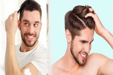 இளவயதிலேயே ஆண்களுக்கு முடி உதிர்வு பிரச்சினையா? இனி இந்த டிப்ஸ்களை ட்ரை பண்ணுங்க