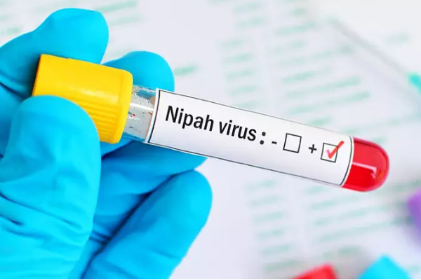 நிபா வைரஸ் தொட்ரபில் இலங்கை மக்களுக்கு வெளியான தகவல் | Nipah Virus Alert Issued For Sri Lanka நிபா வைரஸ் தொட்ரபில் இலங்கை மக்களுக்கு வெளியான தகவல் | Nipah Virus Alert Issued For Sri Lanka