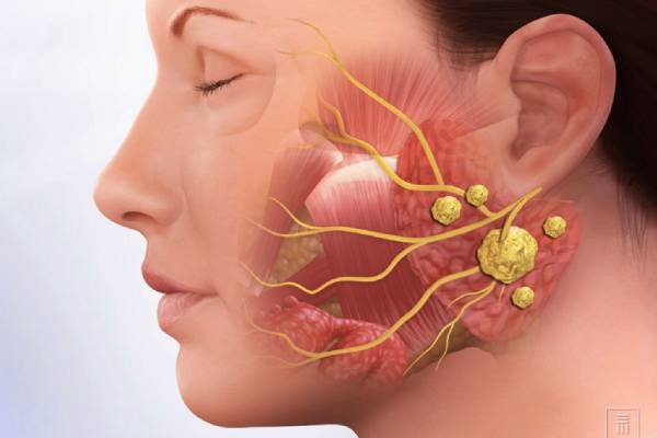 சிறுநீரகத்தில் மட்டுமல்ல இந்த 4 இடத்திலும் கற்கள் உருவாகும் - எங்கு தெரியுமா? | Stones Only In The Kidneys Also In These 4 Places சிறுநீரகத்தில் மட்டுமல்ல இந்த 4 இடத்திலும் கற்கள் உருவாகும் - எங்கு தெரியுமா? | Stones Only In The Kidneys Also In These 4 Places