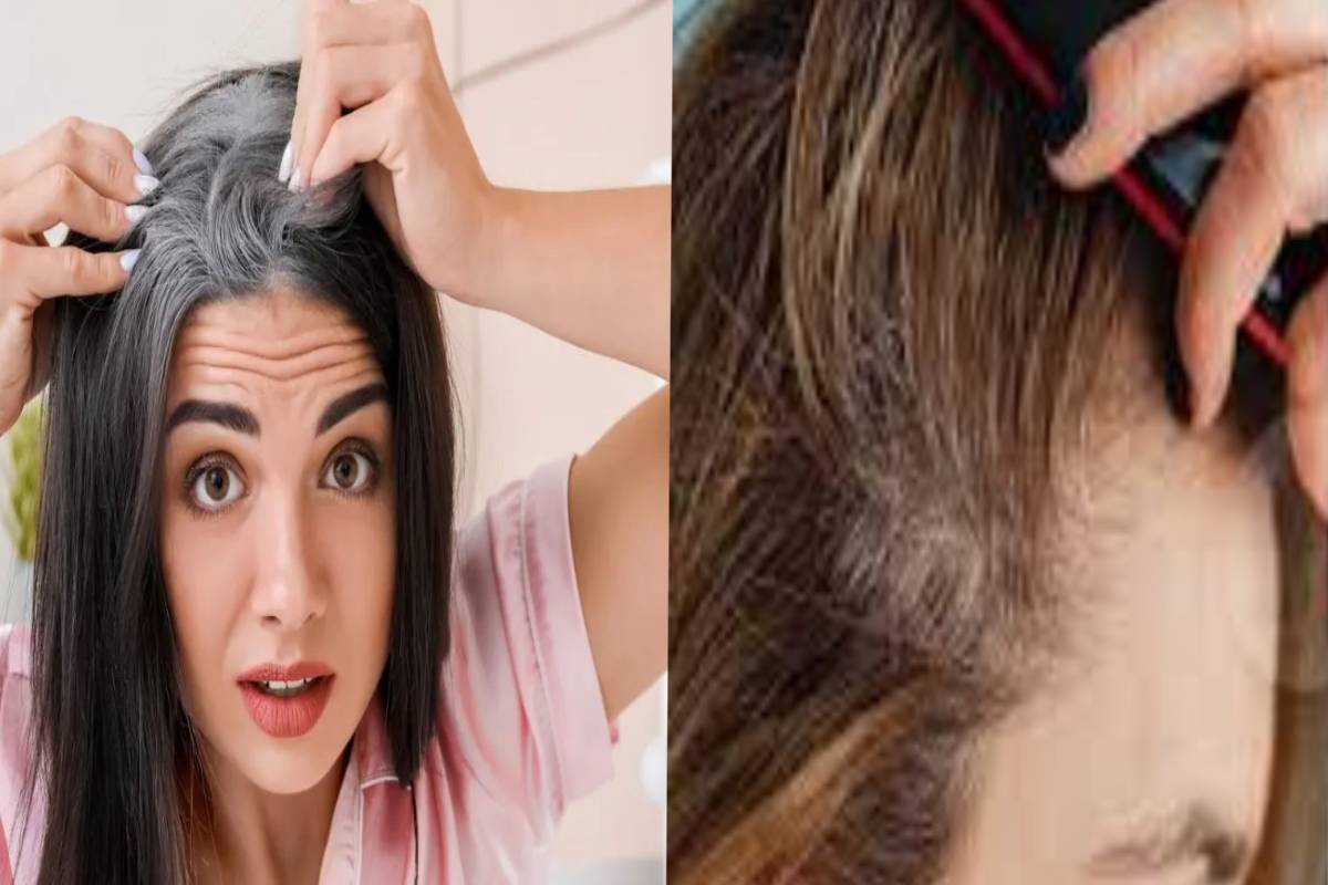 natural home remedies : நரைமுடி பிரச்சினைக்கு இயற்கை தீர்வு! வீட்டிலேயே செய்யக்கூடிய எளிய பராமரிப்புகள் | Best Home Remedies For Gray Hair natural home remedies : நரைமுடி பிரச்சினைக்கு இயற்கை தீர்வு! வீட்டிலேயே செய்யக்கூடிய எளிய பராமரிப்புகள் | Best Home Remedies For Gray Hair