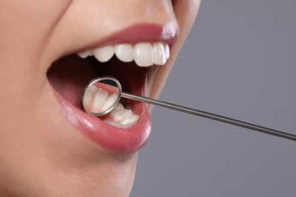இலங்கையர்களை தாக்கும் நோய்; தினசரி 3 மரணங்கள்! | 3 Deaths Daily Due To Mouth Cancer