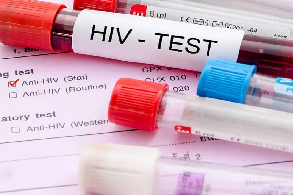 இலங்கையில் எச்.ஐ.வி தொற்றுகள் அதிகரிப்பு | Rise In Hiv Infections Among Men In The Country இலங்கையில் எச்.ஐ.வி தொற்றுகள் அதிகரிப்பு | Rise In Hiv Infections Among Men In The Country