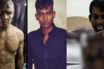 சுண்டுவிரலில் ஏற்பட்ட காயம்... அலங்கோலமான இளைஞரின் பரிதாபநிலை! ஐ பட பாணியில் நிகழ்ந்த கொடுமை