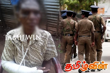 யாழில் கொலை வெறித் தாக்குதல்: சிறுவன் உட்பட ஒரே குடும்பத்தை சேர்ந்த நால்வர் பாதிப்பு