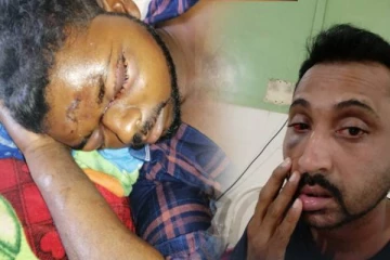 வவுணதீவு பொலிஸாரின் அராஜக செயல்! துப்பாக்கியால் இருவர் மீது சரமாரி தாக்குதல்