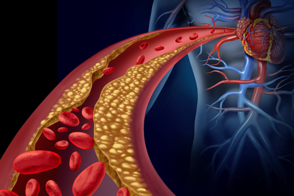 திடீரென்று உயிரை பறிக்கும் மாரடைப்பு! ஆபத்தை தடுக்க என்ன செய்ய வேண்டும்? | Heart Attack