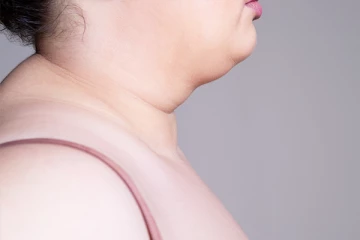 உங்களுக்கு கழுத்தை சுற்றி அதிக சதை இருக்கா ? எப்படி குறைக்கலாம்?