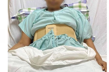 வயிற்றில் 47 கிலோ கட்டியுடன் அவதிப்பட்ட பெண்! மருத்துவர்கள் படைத்த சாதனை