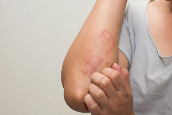 யாரெல்லாம் பாதாம் சாப்பிடவே கூடாது தெரியுமா? | Do You Know Who Shouldn T Eat Almonds