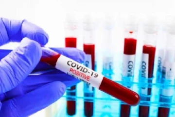 மிரிஸ்வெவ பகுதியில் பெண் ஒருவருக்கு கோவிட் தொற்று உறுதி