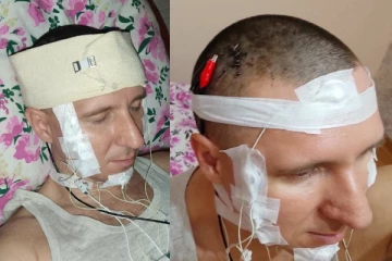 கட்டுப்படுத்த முடியல.. மோசமான முயற்சி செய்த நபர் - மிரண்டு போன டாக்டர்கள்!