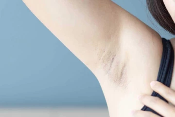 அக்குள் கருமையை போக்கனுமா? இவற்றை மறக்காமல் பின்பற்றினாலே போதும்!