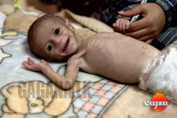 ඉතිහාසයේ නොදුටු ලෙස ගාසාහි දරුවන් සාගතයෙන් මිය යයි [PHOTOS]