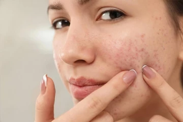 உங்களுக்கு பருவில்லாத பளபளக்கும் முகம் வேண்டுமா? இதோ சில அசத்தலான டிப்ஸ்