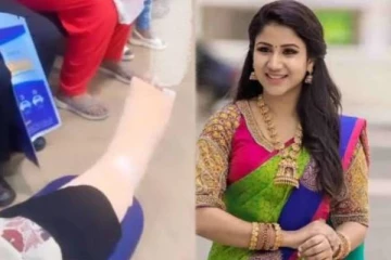 காலில் எலும்பு முறிவு ஏற்பட்ட நடிகை ஆல்யா மானசாவின் தற்போதைய நிலை